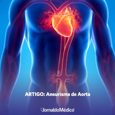 Artigo, aneurisma de aorta
