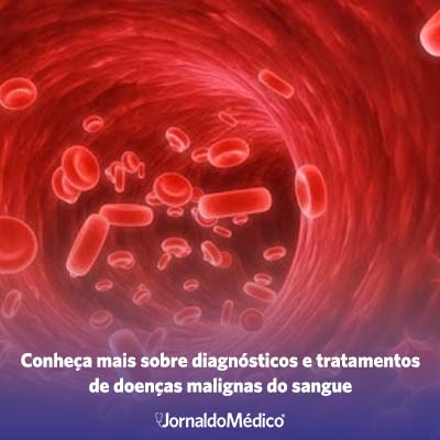 Conheça mais sobre diagnósticos e tratamentos de doenças malignas do sangue