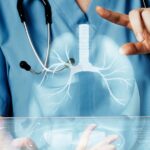 A Fibrose Pulmonar Idiopática afeta milhões de pessoas, mas um novo medicamento mostra-se promissor